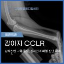 동아엑스레이(X-RAY)메디컬 | [ 강릉 포남동 동물병원 ] 강아지십자인대파열 증상부터 십자인대수술 재활까지