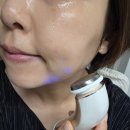 대주메디칼 | 피부과 재생크림 n년째 쓰는 내돈내산 후기(대주메디칼 재생크림)