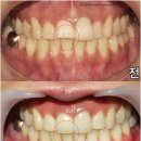 이라인치과기공소 이미지