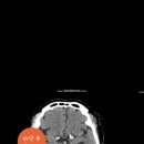 위례재활의학과병원 이미지