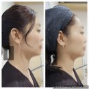 김포장기동 트러블피부관리 루시아에스테틱 방문후기