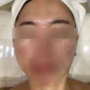 부천 피부관리 신중동 에스테틱 르블랑. 즉각적인 수분관리 효과 솔직후기