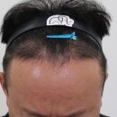 압구정맘모스헤어라인의원 이미지