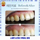 남구 대명11동 인근 치과 성당새로이치과의원 ٩(&#39;ᗜˋ)و CHECK!!