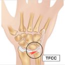 오른쪽 왼쪽 손목 통증 원인 이미지