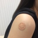 유엔메디컬 | 가다실 9가 (HPV 사람유두종바이러스) 1차 접종 후기 :: 통증 • 부작용 • 비용 💉 부산시 남구 예방...