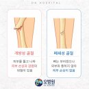 오병원 네이버블로그