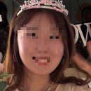 테오그래피광진지점 | W-08 [신부관리] 약손명가 수원인계점 웨딩 신부 경락 내돈내산 후기
