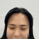 스칼프랩앤뷰티 네이버블로그