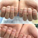네일드엘(nail de el) | [네일드엔] 대전손톱교정 / 대전물어뜯는손톱교정 / 물어뜯는손톱연장 / 남성&여성손톱교정