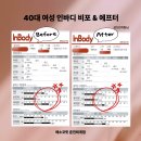 세븐일레븐 춘천세영리첼점 | 춘천 다이어트 에소코핏 퇴계점으로 변화한 40대 여성 인바디 비포 에프터