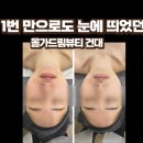 정일파크 | 자양동피부관리 올가드림뷰티 건대입구자양점 특수관리 솔직후기