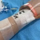 간병투게더 | 편도전절제술 후기,,