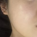 동아대학교 국제전문대학원 | 부산 센텀시티 피부관리 청담민에스테틱, 연어 DNA 피부 리페어 관리 후기