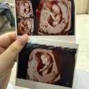 9,10,11,12주차 임산부의 일상이라고나 할깝숑