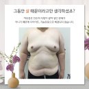 영광비뇨기과의원 | 장유비뇨기과 여유증수술가격은?