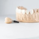 YJ치과기공소 이미지