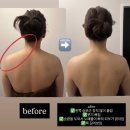 첨단산업5로 | 첨단피부관리 바디톤업순환마사지 에스테틱 로라뷰티하우스 승모근팔뚝관리 만족후기
