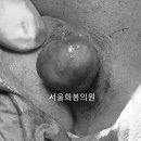 서울화봄의원 네이버블로그