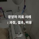광양자 유포톤 면역치료 사례 1 : 비용, 동맥경화 후기
