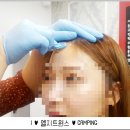 루미오 슈가링 이미지