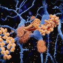 ​두 가지 기존 약물, 알츠하이머 치료의 열쇠가 될까? 이미지