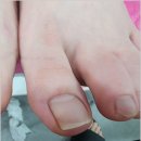 케어네일 이미지
