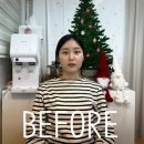 울산 비대칭관리 얼굴축소 잘 하는 곳 추천 솔직후기, 챠밍에스테틱