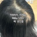 8.0-솔루션 | 관리 잘하는 곳] 채움&amp;그리다 MO100 모발재생 케어 후기 – 다시 자라는 머리카락, 다시 채워지는 자신감