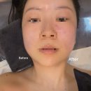 핸드경락 마사지 | 동탄 피부관리 전문 에스테티아 인생 경락 데콜테 후기 (보정 x/b&amp;a)