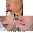 아이로피부과의원 이미지