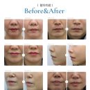 리프업의원 이미지