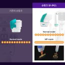 슈링크 유니버스 리프팅, 병원에서 꼭 물어봐야 할 3가지 (효과, 유지기간, 통증 등)