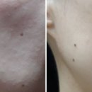 세라케어 이미지
