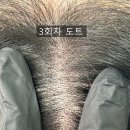 보담 이미지