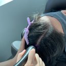 닥터포헤어 대구죽전점 두피탈모센터 이미지