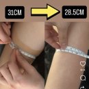 세상담 | 세종 웨딩관리｜팔뚝 슬리밍 효과 바로 본 수예담에스테틱 후기!