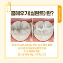 아이홈소아치과의원 이미지