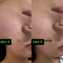 호야짐 | 대전 월평동 호야뷰티 4콤보 관리 후기✨