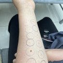 동제약국 | [코 비염 명의] 역삼 하나이비인후과 동헌종 원장님 진료 후기