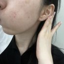 천욱부피부과의원 이미지