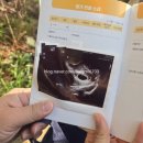 삼성맘편한신경과의원 | 일기 : 임신 5주차 / 아기집 확인/심장소리/마미톡/산모수첩/임신확인서/왕십리산부인과 삼성제이여성의원