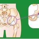 통증 잡는 마사지볼 이미지
