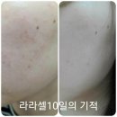 라셀 이미지