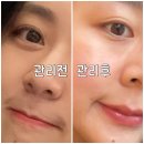 미더베스트 대치점