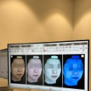 브라이튼피부과의원 | Wedding 6-1. "울쎄라 600샷" 내돈내산 후기 (Feat. 여의도 울쎄라픽 프라임 정품 병원)