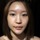 황궁뷰티 | 성신여대 피부관리 [사운드스킨 더블임팩트 관리] 골드링 마사지