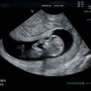 가연농장 | [26년 1월] 임신 8주 ~ 12주 튼튼일기 w. 할일 왤케 많죠?