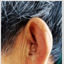 밝은귀보청기 이미지