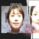 렛미인피부 이미지